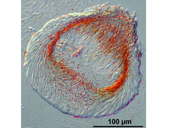 Filicupula suboperculata