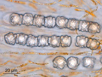 Lamprospora annulata, ascus with ascospores