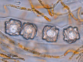 Lamprospora annulata, ascus with ascospores