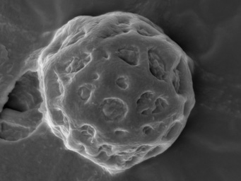 Lamprospora arvensis, spores