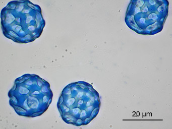 Lamprospora arvensis, spores stained with cotton-blue