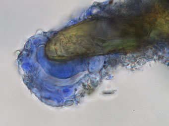 Lamprospora benkertii