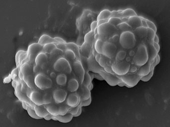 Lamprospora bulbiformis, spores