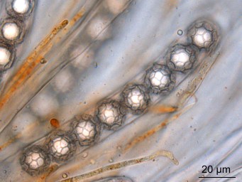 Lamprospora campylopodis, ascus with ascospores