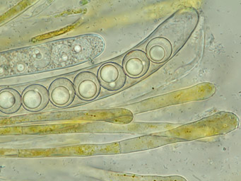 Lamprospora carbonicola, hymenium