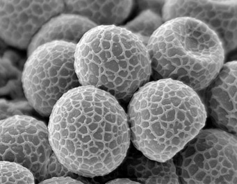 Lamprospora densireticulata, SEM-image of ascospores