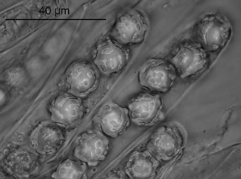 Lamprospora dicranellae, asci with ascospores