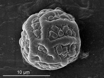 Lamprospora dicranellae, SEM-image of ascospore