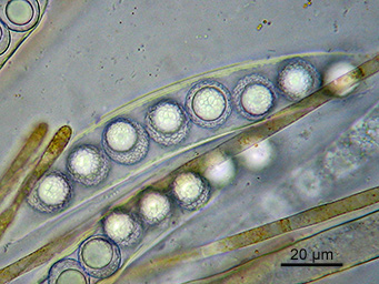 Lamprospora annulata, ascus with ascospores