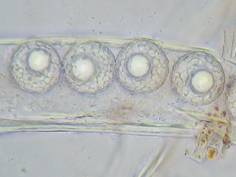Lamprospora ditrichi, ascospores