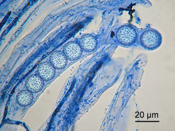 Lamprospora ecksteinii, ascus with ascospores