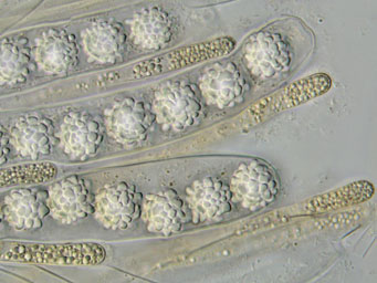 Lamprospora esterlechnerae