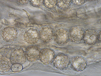 Lamprospora feurichiana