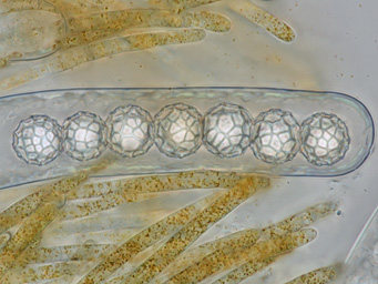 Lamprospora feurichiana