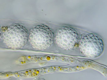 Lamprospora gibbosa, spores