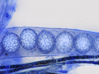 Lamprospora gotlandica, ascospores