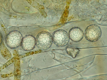 Lamprospora gotlandica, ascospores