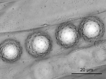 Lamprospora lubicensis, ascus with ascospores