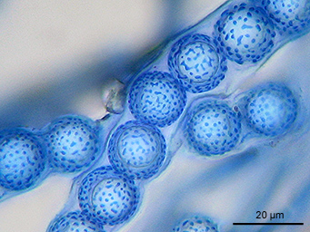 Lamprospora lubicensis, asci with ascospores