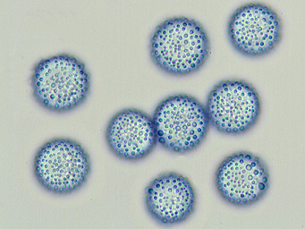 Lamprospora lutziana