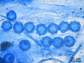 Lamprospora maireana, asci with ascospores