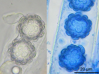 Lamprospora maireana, ascospores