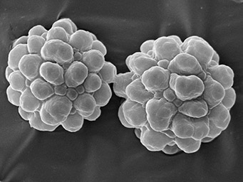 Lamprospora maireana