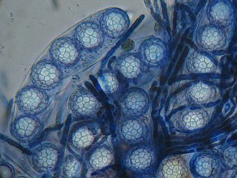 Lamprospora miniata var. parvispora, asci with ascospores