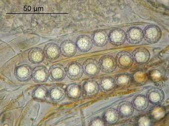 Lamprospora miniata var. parvispora, asci with ascospores