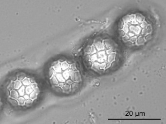 Lamprospora miniata var. ratisbonensis, ascus with ascospores