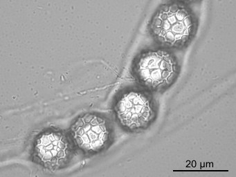 Lamprospora miniata var. ratisbonensis, asci with ascospores