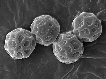 Lamprospora pseudoarvensis, spores