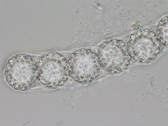 Lamprospora rehmii