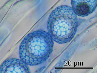 Lamprospora retispora, spores