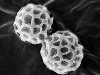 Lamprospora sylvatica, SEM-image of ascospores