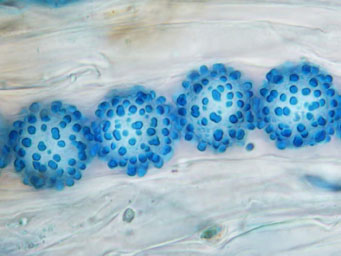 Lamprospora thelespora, spores