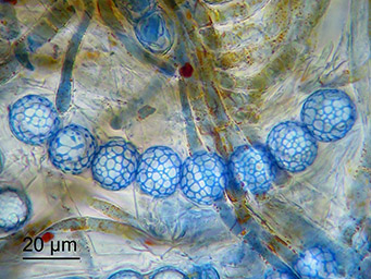 Lamprospora tortulae-ruralis, asci with ascospores