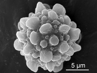 Lamprospora tuberculata, SEM-image of ascospore