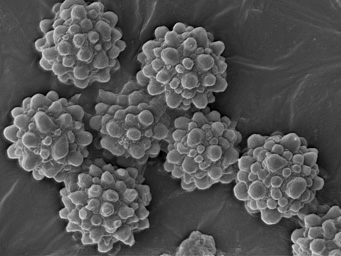 Lamprospora minuta, tuberculata, SEM-image of ascospores