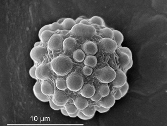 Lamprospora tuberculatella