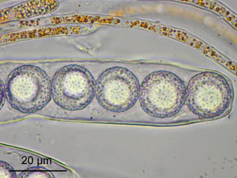 Lamprospora verrucispora, spores