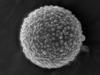 Lamprospora verrucispora, SEM-image of ascospore