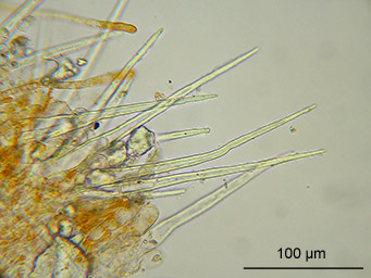 Neottiella ricciae, marginal hairs