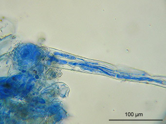Neottiella ricciea, infection