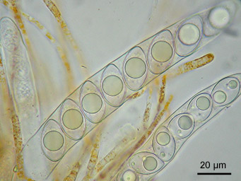 Neottiella ricciae, ascospores