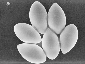 Neottiella ricciae