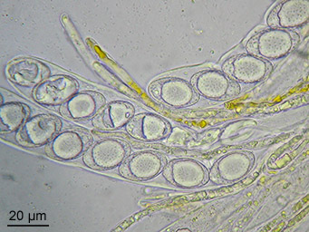 Neottiella vivida, ascospores