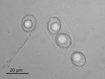 Octospora affinis, free ascospores