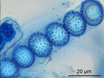 Octospora affinis, free ascospores