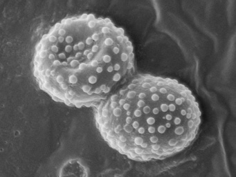Octospora affinis, ascospores